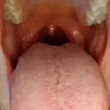 voreguys